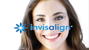 Invisalign orthodontics