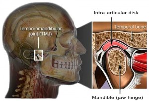 TMJ cutaway